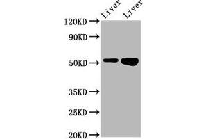 Western Blot Positive WB detected in: Rat liver tissue, Mouse liver tissue All lanes: PRSS16 antibody at 3.