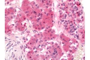 Human Pituitary: Formalin-Fixed, Paraffin-Embedded (FFPE) (FSHR 抗体  (N-Term))