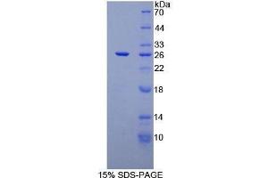 SDS-PAGE (SDS) image for CD72 Molecule (CD72) (AA 169-359) protein (His tag) (ABIN2124389)