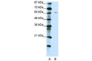 WB Suggested Anti-ZNF286  Antibody Titration: 1. (ZNF286A 抗体  (C-Term))
