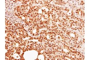 IHC-P Image Immunohistochemical analysis of paraffin-embedded NCI-N87 xenograft, using C9orf78, antibody at 1:500 dilution. (C9orf78 抗体)