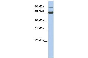 CCDC128 antibody used at 1 ug/ml to detect target protein. (KLRAQ1 抗体  (N-Term))