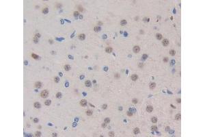 Used in DAB staining on fromalin fixed paraffin- embedded brain tissue (Exonuclease 1 抗体  (AA 1-250))
