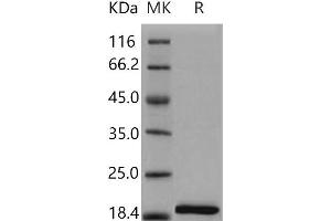Western Blotting (WB) image for Interleukin 1, beta (IL1B) (Active) protein (ABIN7320465) (IL-1 beta 蛋白)