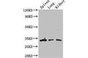 Western Blot Positive WB detected in: Mouse spleen tissue, Mouse lung tissue, Mouse kidney tissue All lanes: ALKBH4 antibody at 3 μg/mL Secondary Goat polyclonal to rabbit IgG at 1/50000 dilution Predicted band size: 34, 5 kDa Observed band size: 34 kDa (ALKBH4 抗体  (AA 1-115))