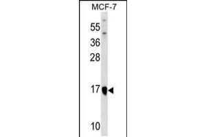 Western blot analysis in MCF-7 cell line lysates (35ug/lane). (ITGB1BP1 抗体  (AA 108-136))