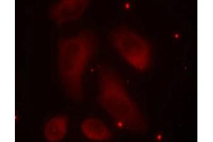 Immunofluorescence staining of methanol-fixed Hela cells using LIMK1(Phospho-Thr508) Antibody. (LIM Domain Kinase 1 抗体  (pThr508))