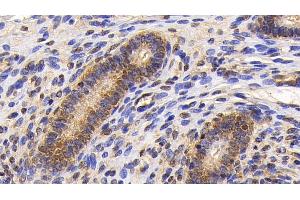 Detection of Surv in Human Uterus Tissue using Monoclonal Antibody to Survivin (Surv) (Survivin 抗体  (AA 1-142))