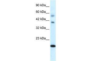 WB Suggested Anti-CGI-143 Antibody Titration:  0. (BOLA1 抗体  (N-Term))