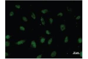 Immunostaining analysis in HeLa cells. (VEZF1 抗体)