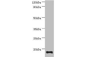 Western blot All lanes: TNNC2 antibody at 10 μg/mL + Mouse skeletal muscle tissue Secondary Goat polyclonal to rabbit IgG at 1/10000 dilution Predicted band size: 18 kDa Observed band size: 18 kDa (TNNC2 抗体  (AA 1-160))