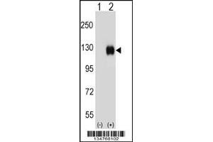 Western blot analysis of Ephb4 using rabbit polyclonal Mouse Ephb4 Antibody using 293 cell lysates (2 ug/lane) either nontransfected (Lane 1) or transiently transfected (Lane 2) with the Ephb4 gene. (EPH Receptor B4 抗体  (AA 360-389))