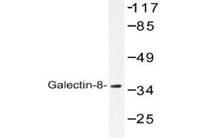 Western blot (WB) analysis of Galectin-8 antibody in extracts from 3T3 cells. (LGALS8 抗体)