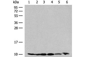 Western blot analysis of 293T and PC3 cell Mouse spleen tissue 231 cell Human breast cancer tissue Mouse kidney tissue lysates using RPS28 Polyclonal Antibody at dilution of 1:200 (RPS28 抗体)