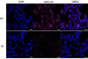 Immunocytochemical staining of HeLa cells using ARFGAP3 antibody (ABIN7797533), 1:1,000), Top panel: wild-type (WT), Bottom panal: ARFGAP3 shRNA knockdown (KD). (ARFGAP3 抗体)