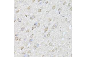 Immunohistochemistry of paraffin-embedded mouse brain using TRAP1 Antibody (ABIN1875197) at dilution of 1:100 (40x lens). (TRAP1 抗体)