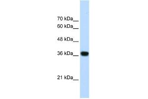 WB Suggested Anti-PSIP1 Antibody Titration:  1. (PSIP1 抗体  (N-Term))