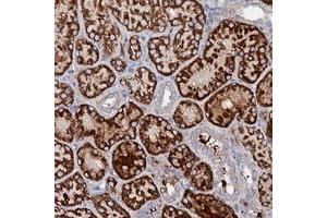 Immunohistochemical staining of human kidney with SLC10A7 polyclonal antibody  shows strong cytoplasmic positivity in cells in tubules at 1:50-1:200 dilution. (SLC10A7 抗体)