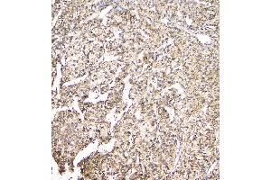 IHC analysis of EVA1A using anti-EVA1A antibody (ABIN6719564). (TMEM166 抗体)