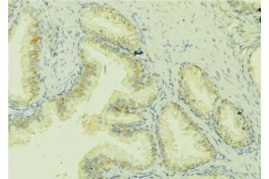 ABIN6279822 at 1/100 staining Mouse colon tissue by IHC-P.