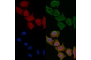 ABIN6261519 and ABIN6266943 staining Hela cells by IF/ICC. (ELOVL1 抗体  (Internal Region))
