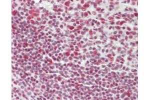 Human Tonsil: Formalin-Fixed, Paraffin-Embedded (FFPE)