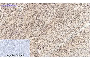 anti-Cyclin A2 (CCNA2) (AA 190-270) antibody