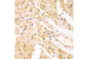 Immunohistochemistry of paraffin-embedded mouse heart using PSMD2 antibody (ABIN1874389) at dilution of 1:100 (40x lens). (PSMD2 抗体)