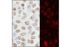 anti-Zinc Finger Protein 295 (ZNF295) (AA 875-925) antibody