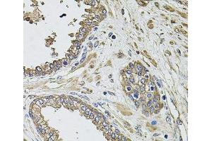 Immunohistochemistry of paraffin-embedded Human prostate using KCNK9 Polyclonal Antibody at dilution of 1:100 (40x lens). (KCNK9 抗体)