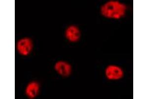 ABIN6266737 staining Hela by IF/ICC. (Histone H1 抗体  (Internal Region))