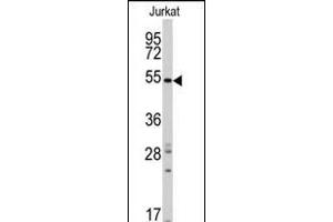Western blot analysis of anti-RAI15 Antibody (C-term) ( (ABIN390172 and ABIN2840666) in Jurkat cell line lysates (35 μg/lane). (SMYD5 抗体  (C-Term))