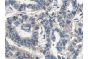 Immunohistochemistry (IHC) image for anti-V-Erb-A erythroblastic Leukemia Viral Oncogene Homolog 4 (Avian) (ERBB4) (AA 29-278) antibody (ABIN7440776)
