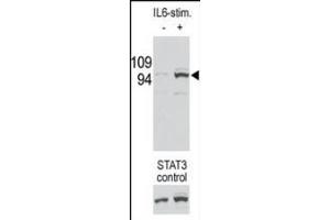 Image no. 1 for anti-Signal Transducer and Activator of Transcription 3 (Acute-Phase Response Factor) (STAT3) (pSer727) antibody (ABIN357083) (STAT3 抗体  (pSer727))