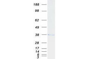 Western Blotting (WB) image for Calcium Binding Protein 4 (CABP4) protein (Myc-DYKDDDDK Tag) (ABIN2713003)