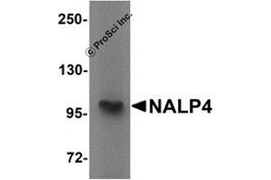 Western Blotting (WB) image for anti-NLR Family, Pyrin Domain Containing 4 (NLRP4) (Middle Region) antibody (ABIN1031008) (NLRP4 抗体  (Middle Region))