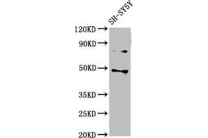 Western Blot Positive WB detected in: SH-SY5Y whole cell lysate All lanes: CSNK1E antibody at 3 μg/mL Secondary Goat polyclonal to rabbit IgG at 1/50000 dilution Predicted band size: 48 kDa Observed band size: 48 kDa (CK1 epsilon 抗体  (Isoform epsilon))