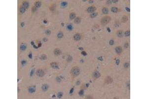Used in DAB staining on fromalin fixed paraffin- embedded Kidney tissue (FAM19A3 抗体  (AA 30-129))