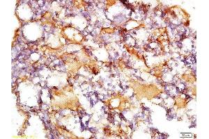 Immunohistochemistry (Paraffin-embedded Sections) (IHC (p)) image for anti-Collagen, Type IV (COL4) (AA 1401-1500) antibody (ABIN728413)