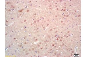Formalin-fixed and paraffin embedded rat brain labeled with Rabbit Anti SAMD14 Polyclonal Antibody, Unconjugated (ABIN718346) at 1:200 followed by conjugation to the secondary antibody and DAB staining (SAMD14 抗体  (AA 231-330))