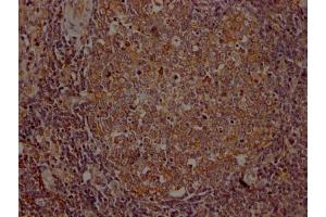 IHC image of ABIN7127585 diluted at 1:100 and staining in paraffin-embedded human lymph node tissue performed on a Leica BondTM system. (Recombinant ITK 抗体)