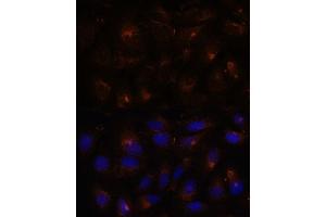 Immunofluorescence (IF) image for anti-Extended Synaptotagmin-Like Protein 1 (ESYT1) (AA 90-220) antibody (ABIN7267069)