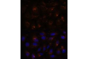 Immunofluorescence analysis of U-2 OS cells using ESYT1 antibody (ABIN7267069) at dilution of 1:100. (ESYT1 抗体  (AA 90-220))