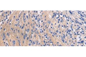 Immunohistochemistry of paraffin-embedded Human brain tissue using GALR3 Polyclonal Antibody at dilution of 1:50(x200) (GALR3 抗体)