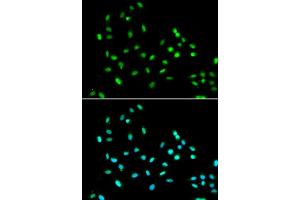 Immunofluorescence analysis of A549 cell using SMARCAD1 antibody. (SMARCAD1 抗体)