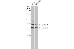 WB Image Various whole cell extracts (30 μg) were separated by 7. (Lamin A/C 抗体)