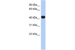WB Suggested Anti-RASGEF1C Antibody Titration: 0. (RASGEF1C 抗体  (N-Term))