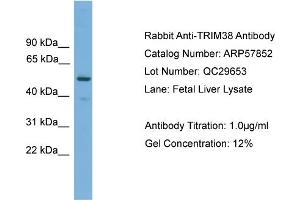 WB Suggested Anti-TRIM38  Antibody Titration: 0. (TRIM38 抗体  (Middle Region))