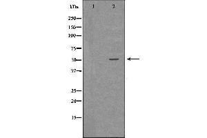 Western blot analysis of Hepg2 whole cell lysates, using CTSA Antibody. (CTSA 抗体  (C-Term))