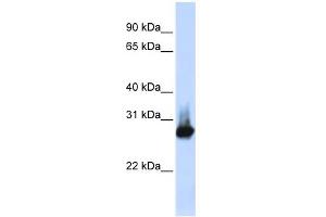 WB Suggested Anti-BCAP31 Antibody Titration:  0. (BCAP31 抗体  (Middle Region))